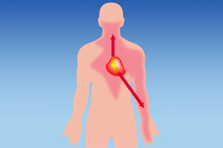 درد قفسه سینه ناشی از بیماری قلبی