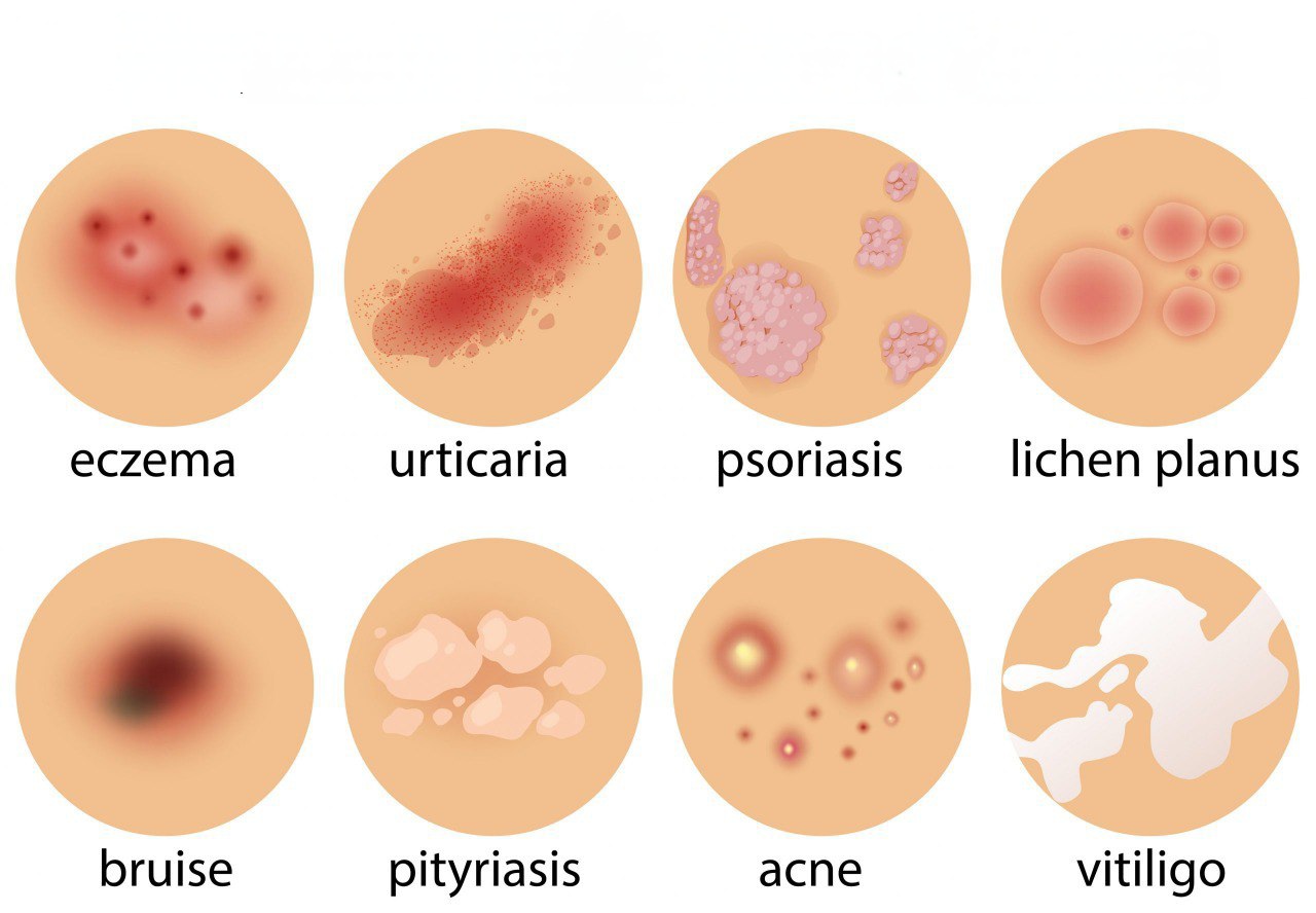 انواع بیماری‌های پوستی