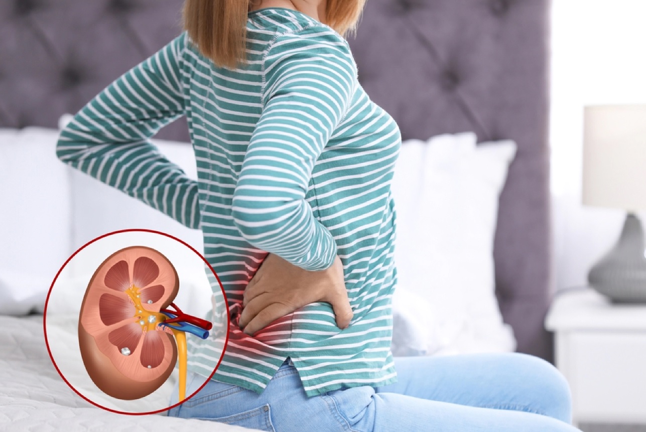 بیماری‌های ادراری و کلیوی مرتبط با زنان