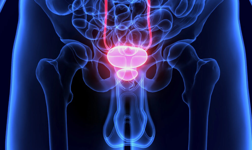 علائم سرطان پروستات