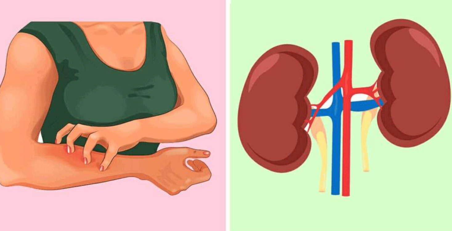 علائم بیماری کلیوی در زنان