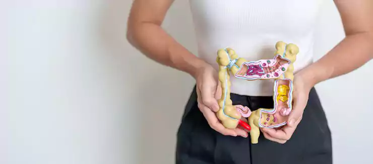 گرفتگی شکم بدون پریود با بیماری التهابی روده