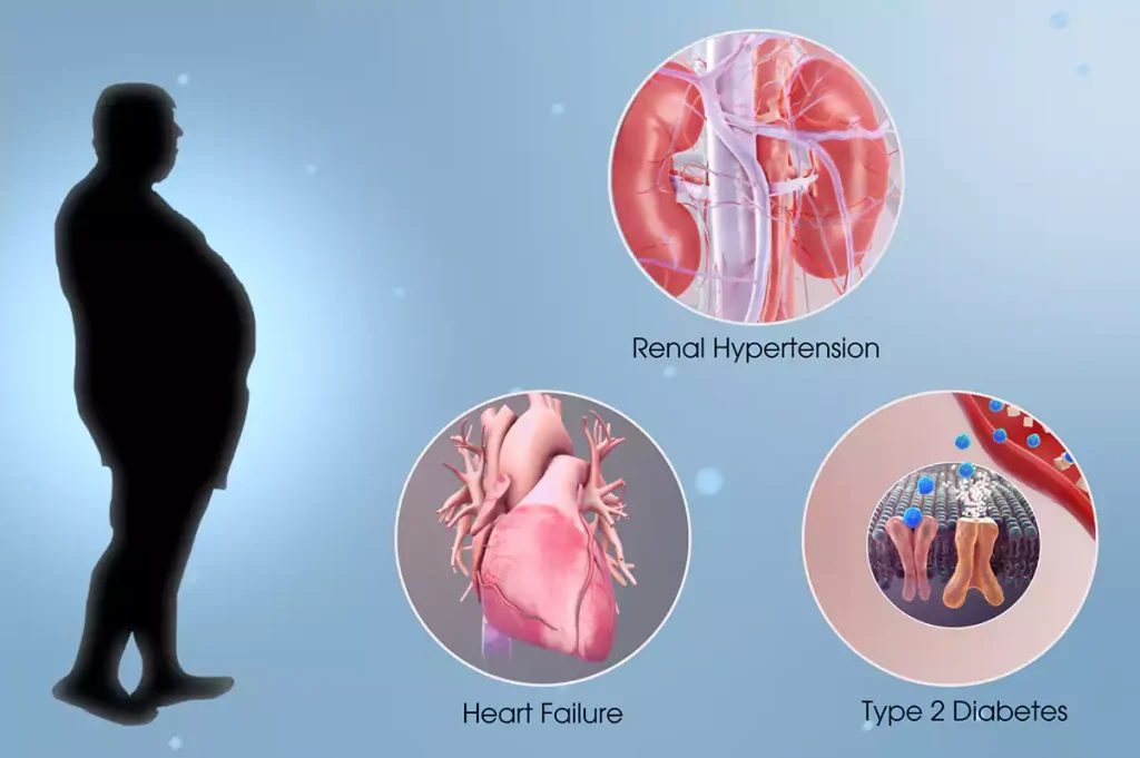 علائم هشداردهنده سندرم متابولیک