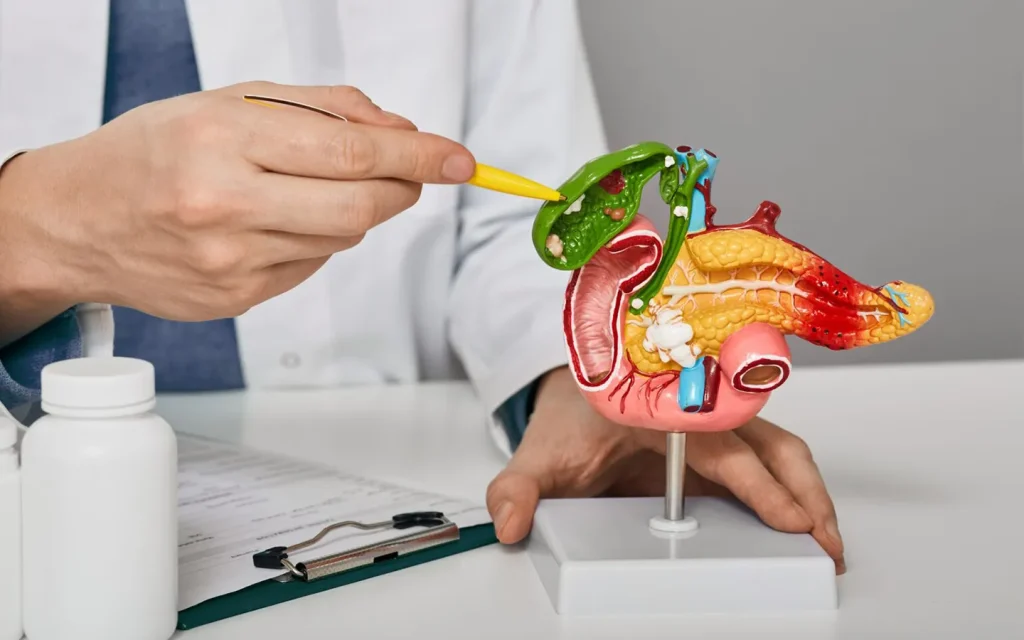 بیماریهای شایع کیسه صفرا،علائم،تشخیص و روش های درمان