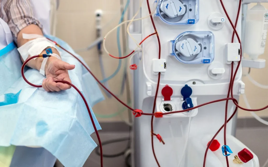 دیالیز چگونه کار می‌کند و نقش حیاتی آن در پاکسازی خون چیست؟