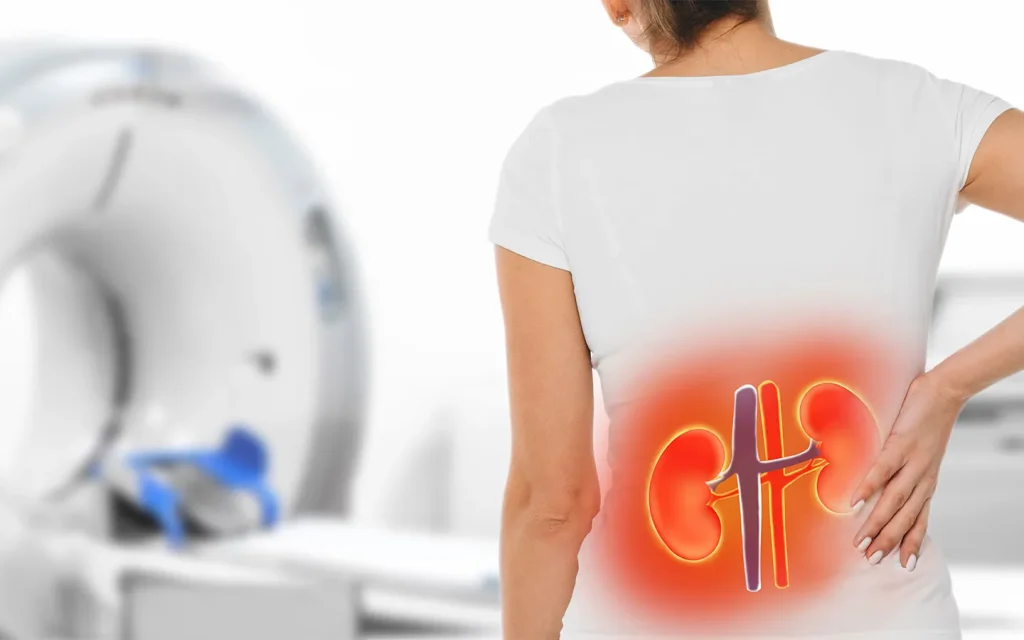 علائم هشداردهنده اولیه مشکلات کلیوی در زنان